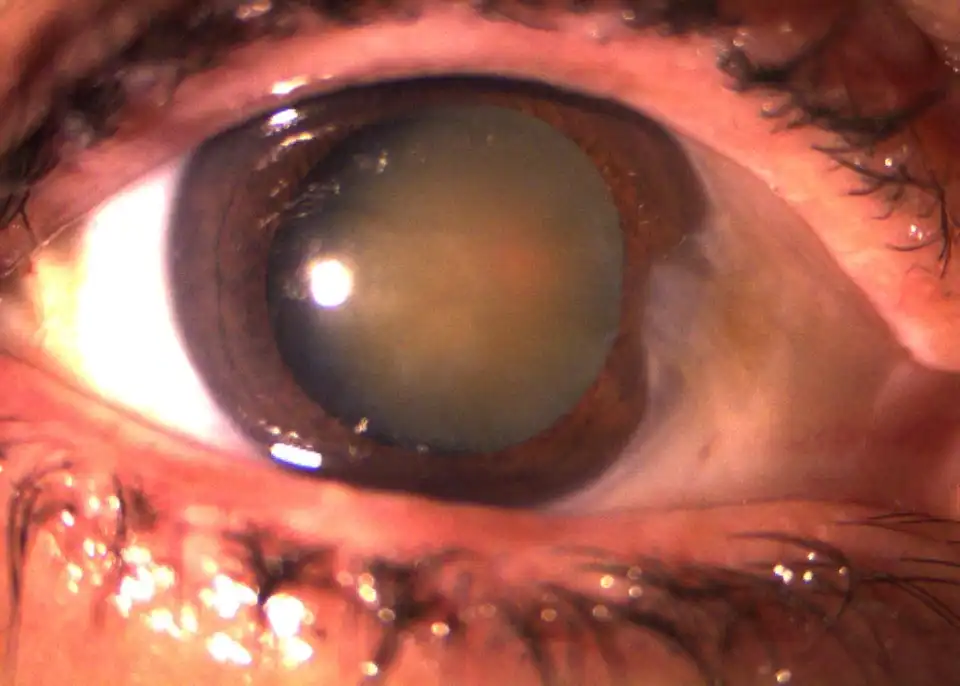 1 pré.JPG 1 pré.JPG