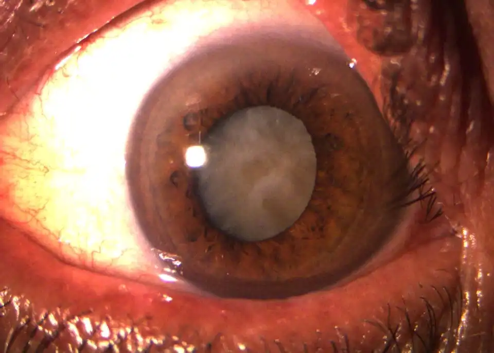 3 pré.JPG 3 pré.JPG