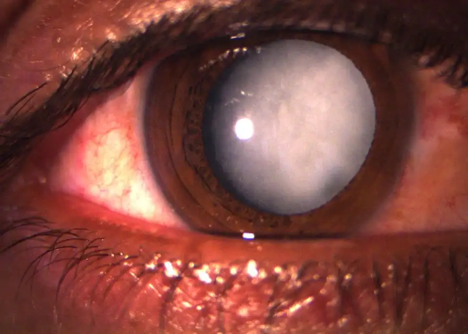 6 pré.JPG 6 pré.JPG